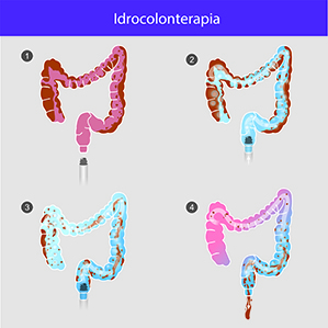 Idrocolonterapia Idrocolonterapia